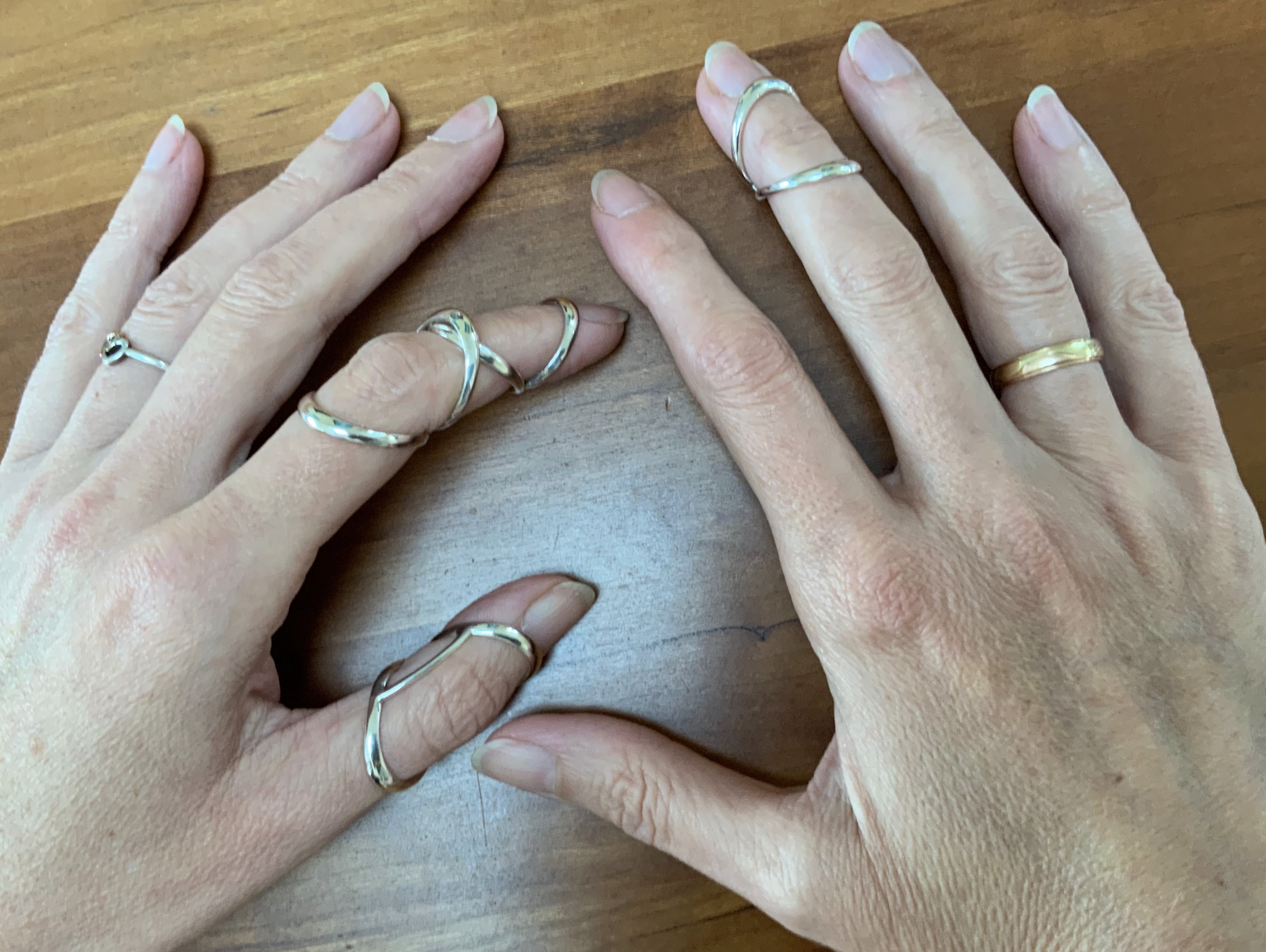 Close-up of a hand wearing multiple custom-made silver splint rings on the finger joints, providing support for hypermobility.
